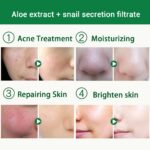 BAIMISS Snail Serum Aloe Vera Gel Face Cream Skin Care Repair Acne Treatment Blackhead Remover Acne Scar Removal Moisturizing 4
