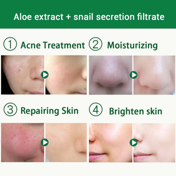 BAIMISS Snail Serum Aloe Vera Gel Face Cream Skin Care Repair Acne Treatment Blackhead Remover Acne Scar Removal Moisturizing 3