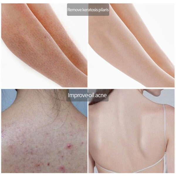 MICAOJI Rose Moisturizing Body Cream Scrub Cream Natural face Exfoliator Remove acne Skin Care Brightening Plant Whitening 200g 3